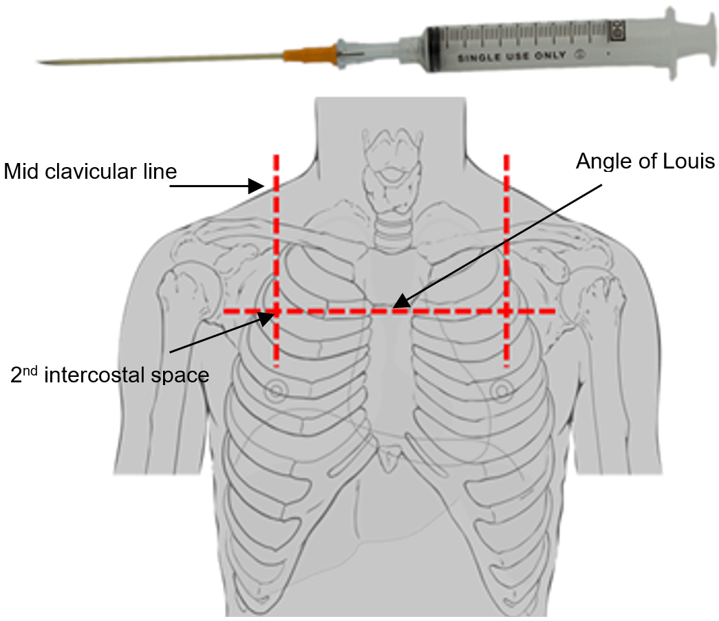 Needle2